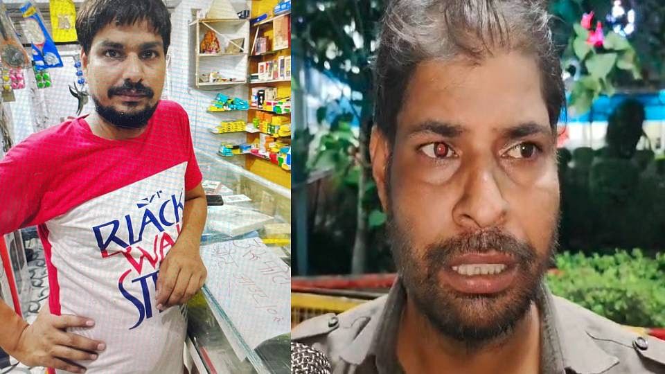 पुलिस कस्टडी में युवक की मौत: भाई की आंखों देखी, 'वह पानी मांग रहा था... किसी ने नहीं पिलाया; तड़पकर तोड़ा दम elder brother told truth said his brother was tortured In case of death of young man in police custody lucknow